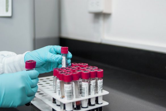Próbówki w laboratorium